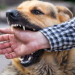 San Jose dog bite attorney san jose dog bite lawyer West Covina Dog Bite Attorney