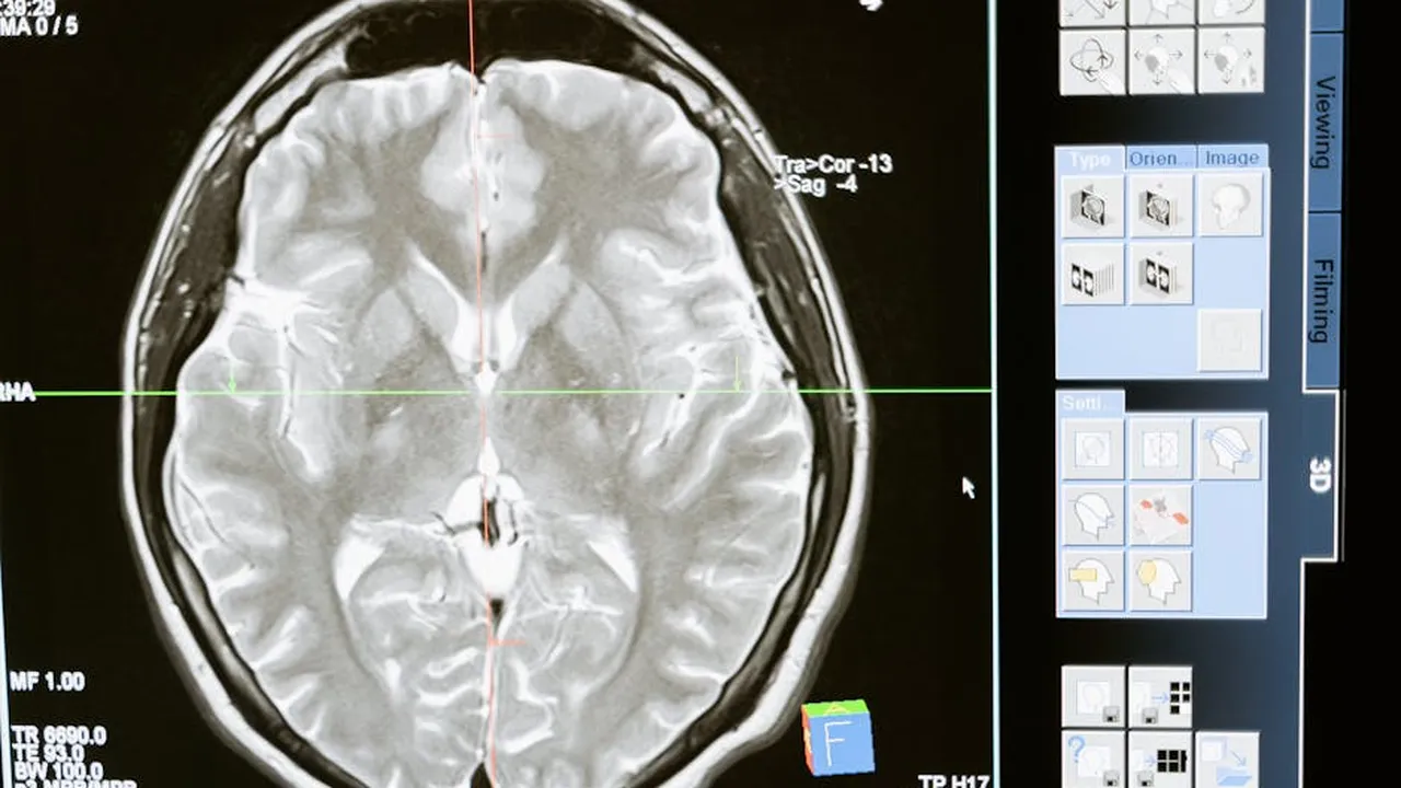 Medical brain scan imagery for trauma diagnosis